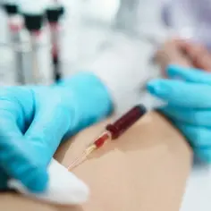 Felczer pobiera krew do strzykawki z żyły pacjenta.